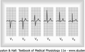 differently between the various leads Precordial Leads The Normal Electrocardiogram Often ECGs are measured with one positive electrode over the heart at one of six possible points and one negative