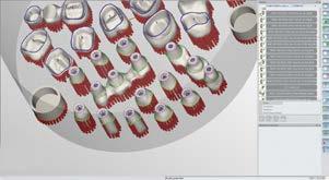 9 Hybrid manufacturing: Cost efficiency combined with outstanding precision Manufacturing dental implants requires the utmost precision.