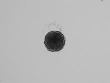 3-D Culture Spheroid Proliferation/Viability Image Analysis 300000 120% Area (µm 2