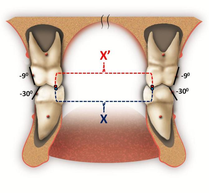 ELEMENT IV Optimal Jaw Heights 15-25 Jaw heights are optimal when: the tooth positions are Element I,