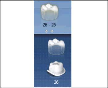 Sirona Dental Systems GmbH 8 Design examples 8.1 Abutment - Biogeneric individual - MultiLayer 8.1.10 Adjusting parameters Instructions The step "Restoration Parameters" is active. 1.