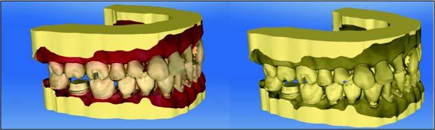 Sirona Dental Systems GmbH 7 Edit orders 7.1 Tools and functions of the page palette 7.1.4 Analysis tools model Color model Using the "Color Model" button, you can change the color of models that were acquired with the CEREC Omnicam.