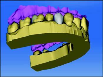 7 Edit orders Sirona Dental Systems GmbH 7.1 Tools and functions of the page palette 7.1.5 Articulation The "Articulation" function enables you to configure a restoration taking the dynamics into consideration.