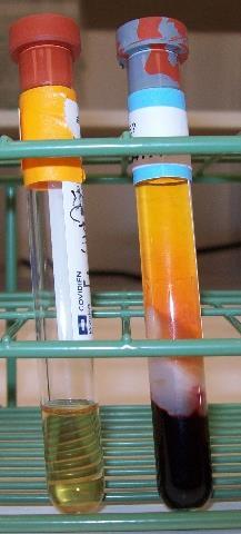Heat causes hemolysis, which may be severe enough that specimens are not suitable for processing.
