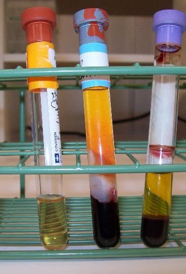 When using EDTA tubes, make sure the blood and anti-coagulant are thoroughly mixed and keep the specimens out of direct sunlight.