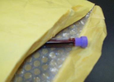 shipping blood tubes. Unidentified containers and incomplete or missing paperwork delay testing.