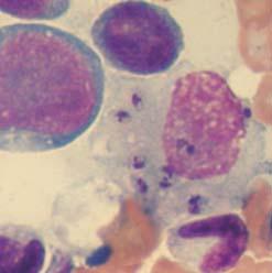 Direct diagnostic methods: CYTOLOGY Demonstration of amastigotes in