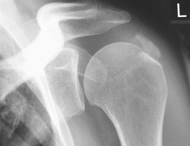 52 A case example A woman, 46 years of age, a secondary school teacher presented with intense pain in her left shoulder.