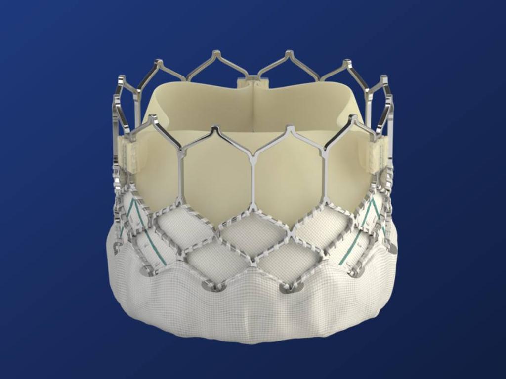 SAPIEN 3 Transcatheter Heart Valve Distinguishing Features Enhanced frame geometry for low
