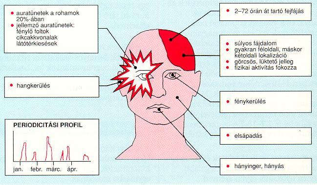 MIGRAINE AURA SIGNS IN 20% OF ATTACKS; USUALLY VISUAL AURA ZIG-ZAG LINES, BRIGHTING SPOTS ACCOMPANYING SIGNS: PHONOPHOBIA DURATION: 2-72 HOURS SEVERE PAIN; MOSTLY UNILATERAL;