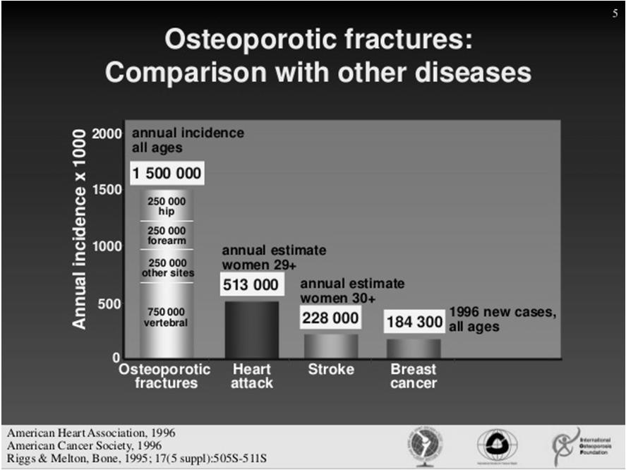 Hormone therapy & Osteoporosis 16.