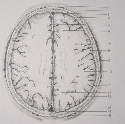 Cortex, grey matter 9. Cerebral vessels 10. Temporal lobe 11. Occipital lobe 12.