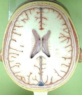 TRANSVERSE SECTION PLANE 3 1. Cranium 2. Superior sagittal sinus 3. Falx cerebri 4. Dura mater 5.