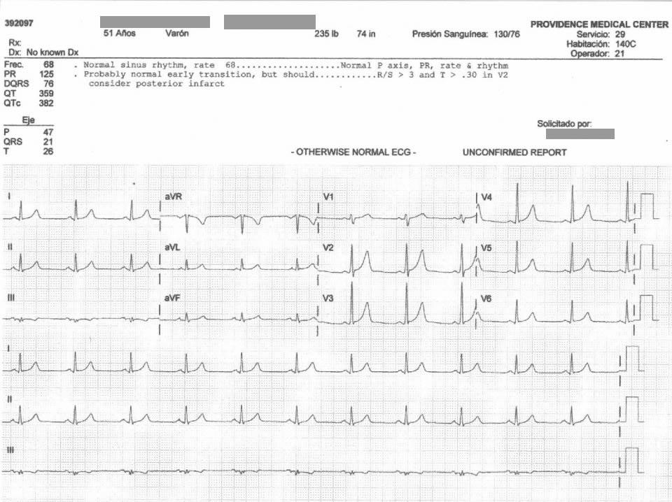 ACI s Case Study ACI performs Centralized ECG interval and Morphology interpretation of Digital or Paper ECGs ECG Analysis Process First, Interval wave forms are measured either by a digitizing