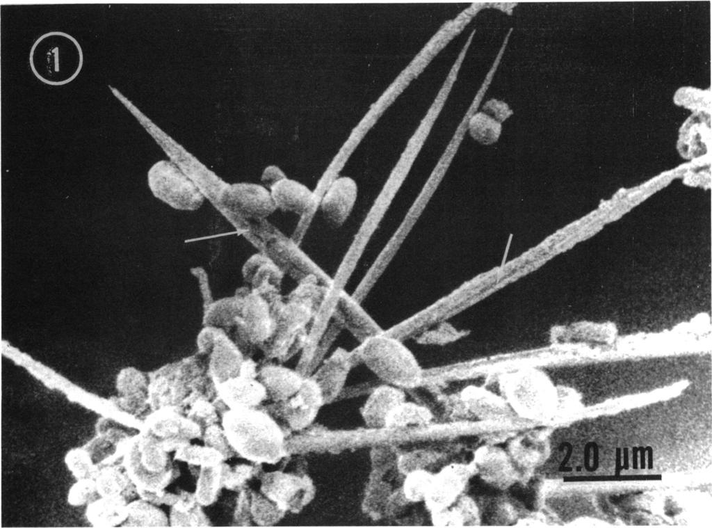 VOL. 115, 1973 ELECTRON MICROGRAPH STUDY OF METSCHNIKOWIA 317 1). SEM examination of digested asci of M.