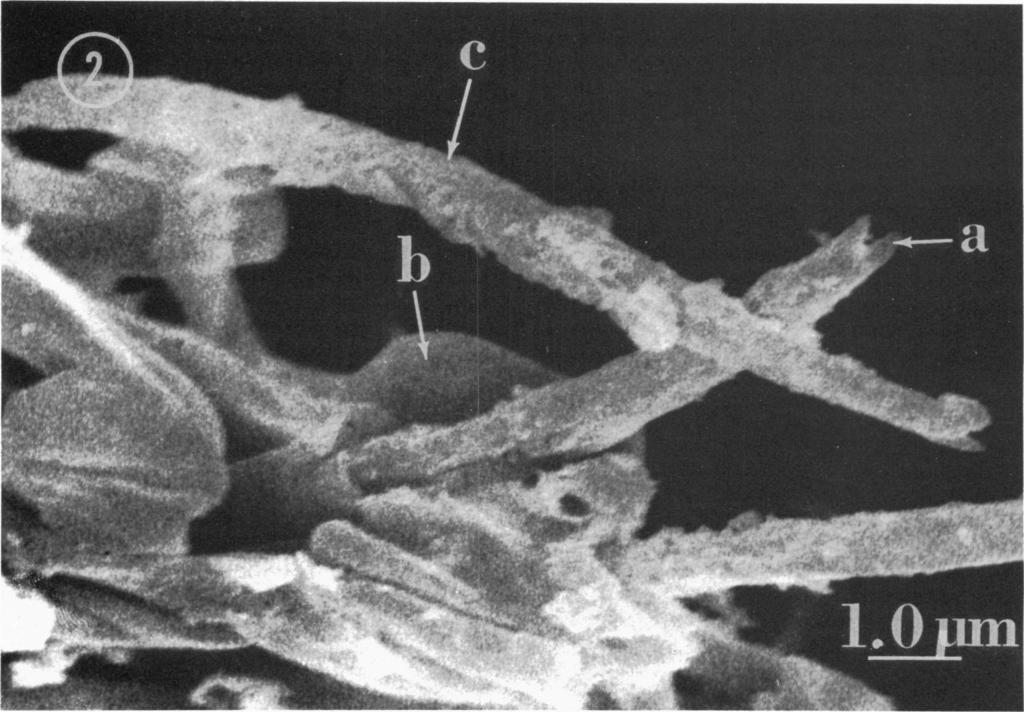 318 TALENS, MILLER, AND MIRANDA J. BACTERIOL. FIG. 2. Scanning electron micrograph of sporulating cells of M. krissii digested with snail gut enzymes.