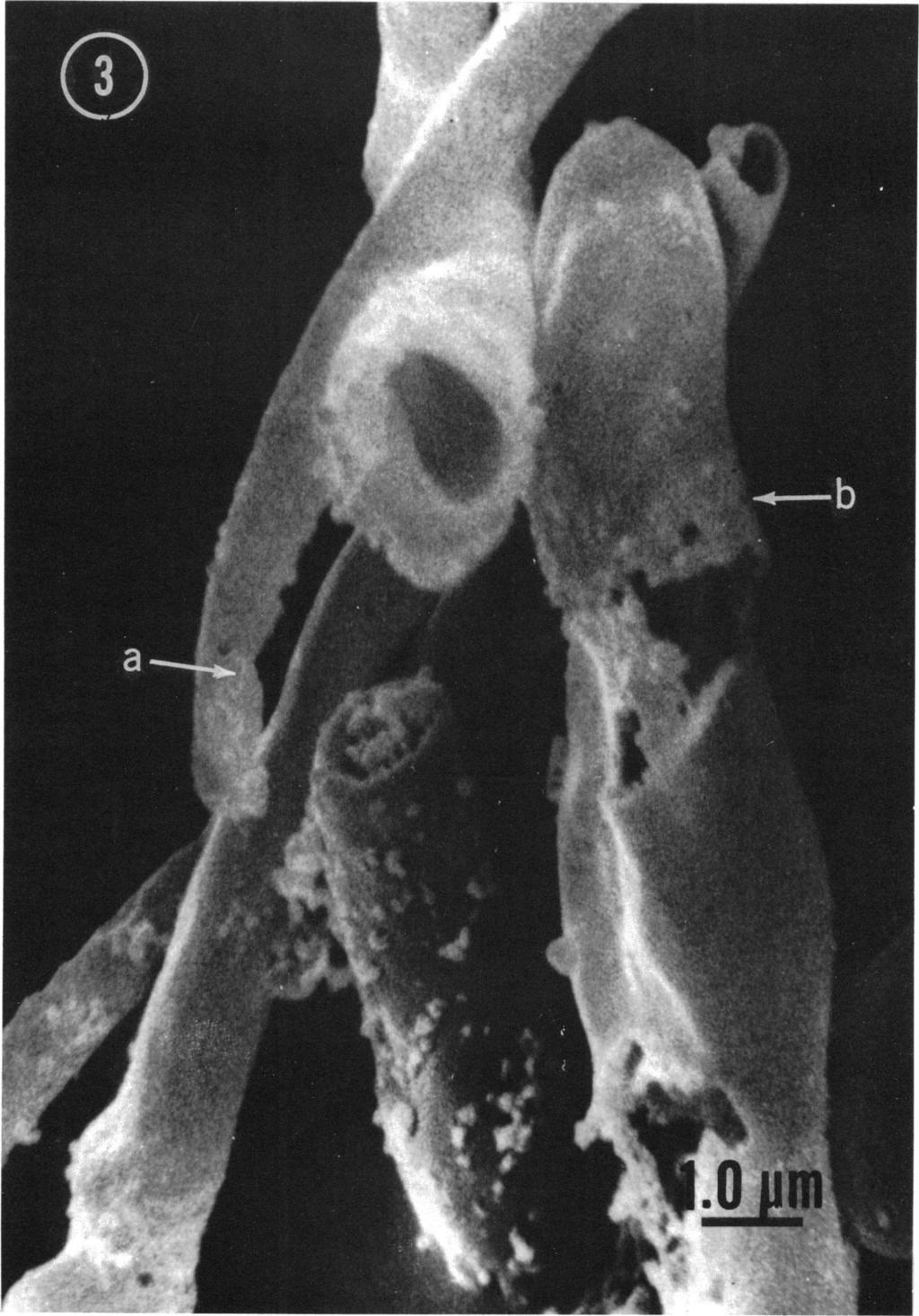VOL. 115, 1973 ELECTRON MICROGRAPH STUDY OF METSCHNIKOWIA 319 FIG. 3. Scanning electron micrograph of sporulating cells of M.