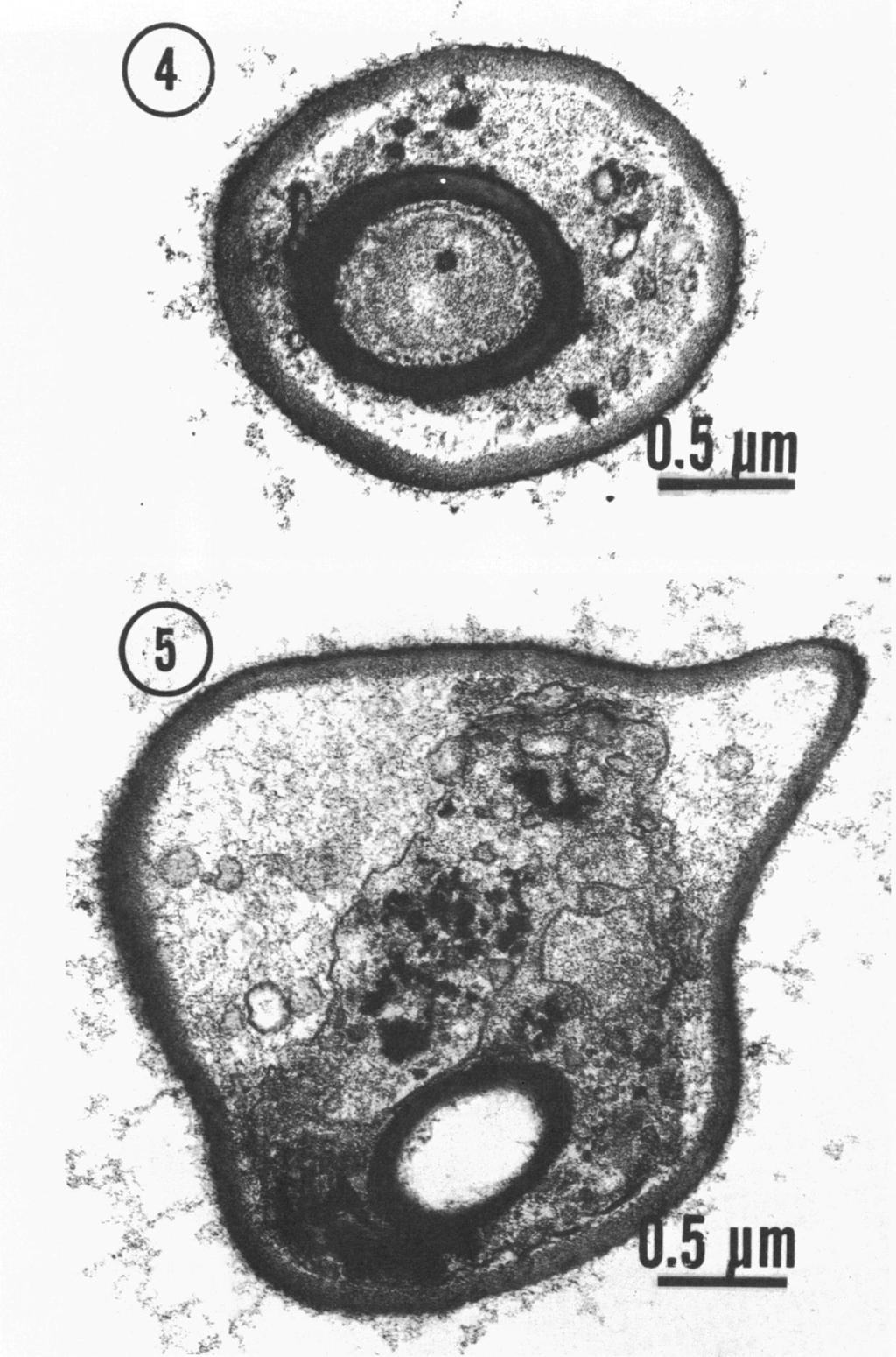 320 TALENS, MILLER, AND MIRANDA J. BACTERIOL. o.- FIG. 4. Thin section of an ascus of M. krissii containing a single ascospore. The cross section is from the pedunculate portion of the ascus.