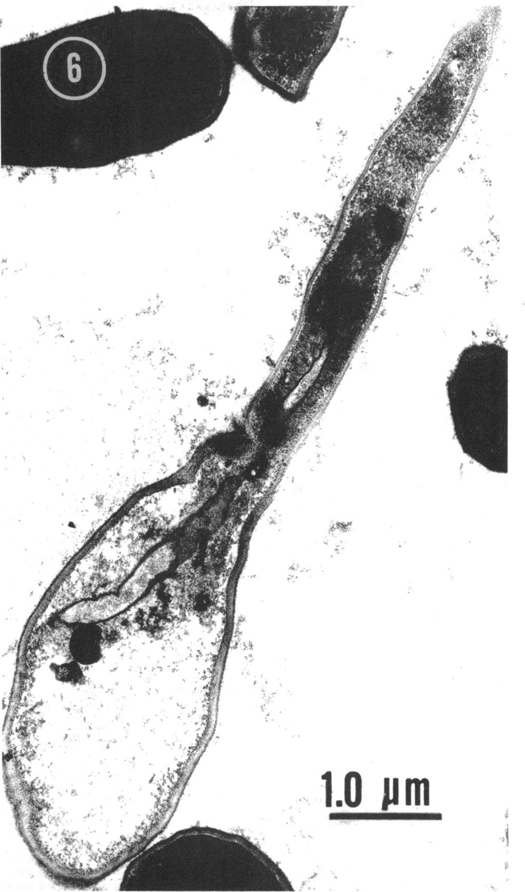 VOL. 115, 1973 ELECTRON MICROGRAPH STUDY OF METSCHNIKOWIA 321 'V. sl Ṣ-8 j S j~~~~!.s S;t Lllm~~~~~~~~~- l.o.1r'> FIG. 6. Thin section of an ascus of M. krissii containing an ascospore.