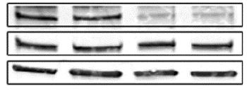 Epigense LSD1 Demethylse tivity Kit (fluorometri, sensitivity = 2 ng purified protein) (Epigentek, Frmingdle, NY) ording to mnufturer s reommendtions.