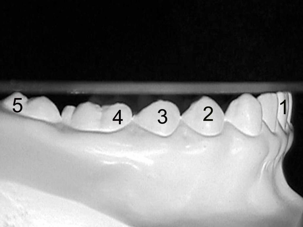 Betina R. Pereira et al. Introduction The normal occlusion presents a curve determined by the occlusal surfaces of the mandibular teeth.