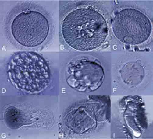 Figure 1. Normal and abnormal morphology oocytes: (A) normal oocyte, (B, C) cytoplasmic vacuoles, (D, E) fragmentation, (F) perivitelline debris, and (G, H, I) abnormal zona pellucida and cytoplasm.