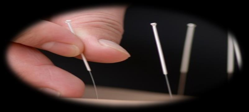 Energy Techniques Acupuncture/Acupressure May reduce: Chemo-induced