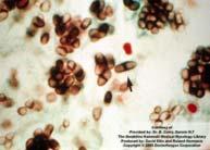 presence of cyclohexamide Trichophyton -Macroconidia rare -Microconidia numerous