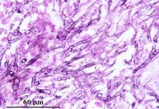 Pneumocystis jiroveci Aspergillus IFA GMS In soil; conidia in air
