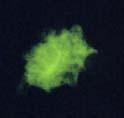Aspergillus H&E Galactomannan antigen detection a major constituent of