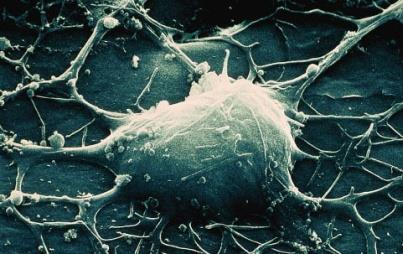 Neuron General structure Histology Receptive, conductive, secretory components