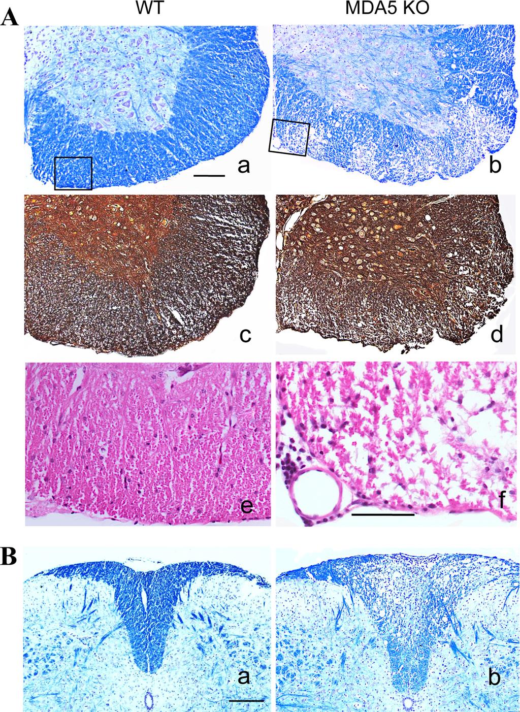 Jin et al. FIG 3 Focal demyelinated lesions and axonal damage in the spinal cords of virus-infected MDA5 KO mice.