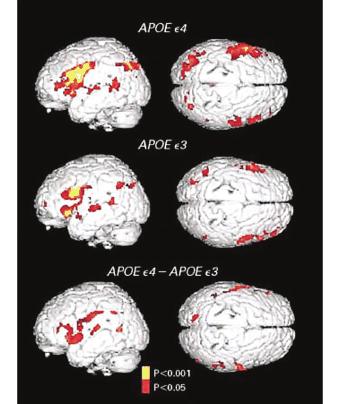 Memory Activation & APOE ε4 Risk gene for Alzheimer s 16