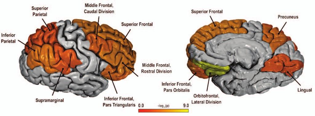 Cortical Thickness GWA Association found at rs2342227 (p=4.0x10-10), chr 13q31, near SLIT- & NTRK-like family, member 6.