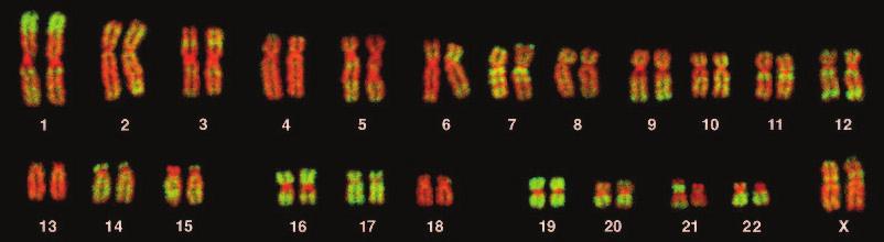 Human Genome 23 Chromosomes
