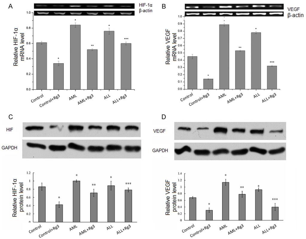 Figure 2. Rg3 inhibits VEGF and HIF-1α expression in BMSCs. RT PCR assay of VEGF mrna level (A) and HIF-1α mrna level (B) in BMSCs derived from control subjects, AML and ALL patients.