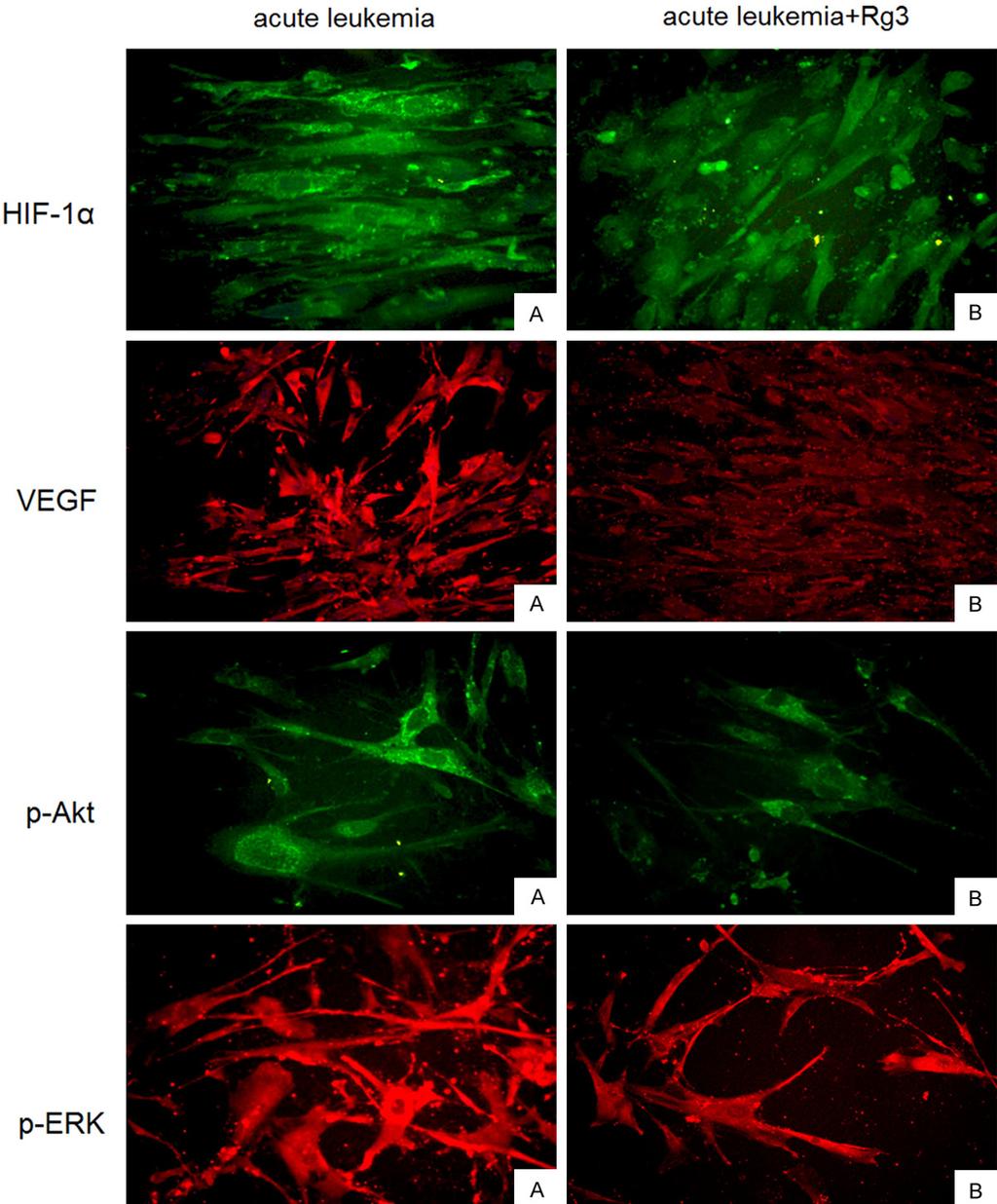 Figure 4. Localization of HIF-1α, VEGF, and phosphorylated ERK and Akt in BMSCs.