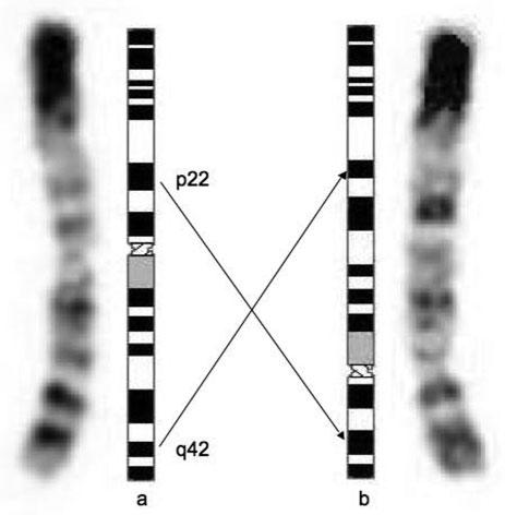 S.Chantot-Bastaraud et al. Cambridge, UK), and the chromosome 1q telomere-specific probe, labelled with Texas Red (Aquarius, Cytocell Technologies), were hybridized simultaneously.