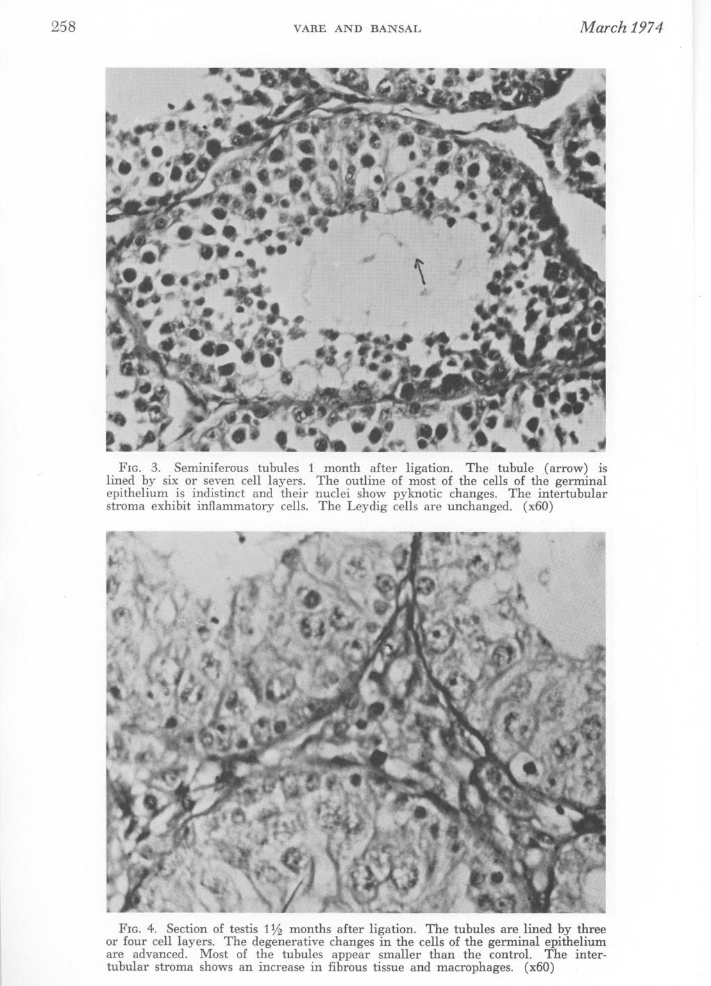 258 VARE AND BANSAL March 1974 FIG. 3. Seminiferous tubules 1 month after ligation. The tubule (arrow) is lined by six or seven cell layers.