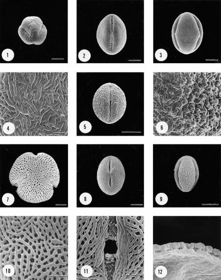 12 M. Grant et al. Figs. 1 ± 4. SEM of pollen of Micromelum minutum, type 1.