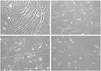 (A) Cytoplasmatic protein fractions (CF) and crude nuclear extracts (NE) prepared from CO, FoxO3a KD, Cdc7 KD and doubly depleted Cdc7/FoxO3a (Cdc7 KD /FoxO3a KD ) IMR90 cells 48 h post-transfection
