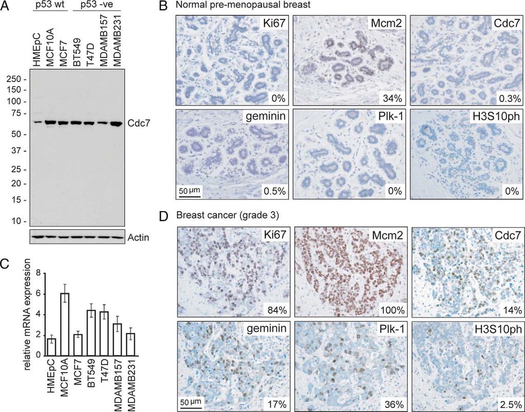 Cdc7 targeting in p53-mutant breast cancer Figure 2. Cdc7 expression in breast epithelial cell lines and tissue.