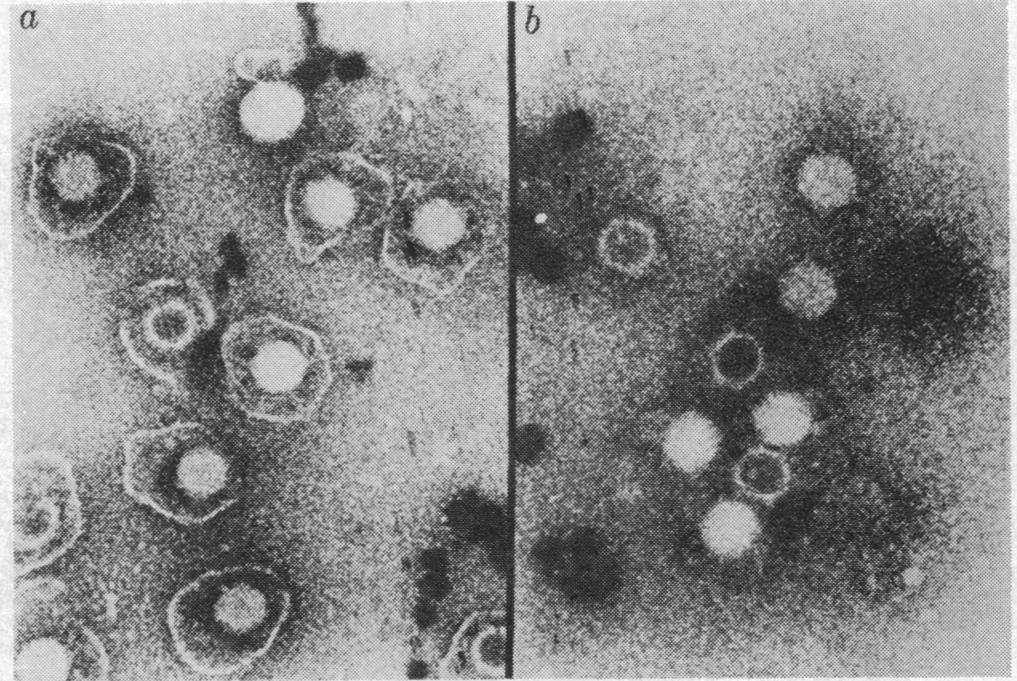 VOL. 66, 1970 MICROBIOLOGY: KAPLAN AND BN-PORAT 803 a b. FIG. 3.-lectronmicrograolhs of Triton-treated and untreated viral particlbs. (a) Untreated. (b) Triton-treated.