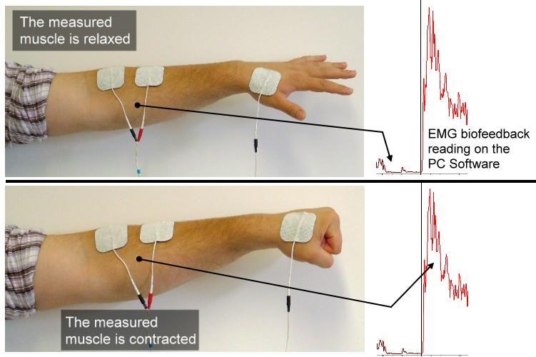 Muscle EMG Electrode sensor Pattern Recognize Classifier EMG Recording Reduction method Noise Reduction EMG feature extraction 2. Literature Survey Figure 1.