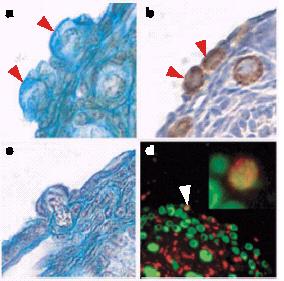 Germline stem cells present in the ovary, outside
