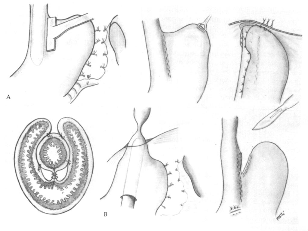 576 The Annals of Thoracic Surgery Vol 26 No 6 December 1978 Fig 1.