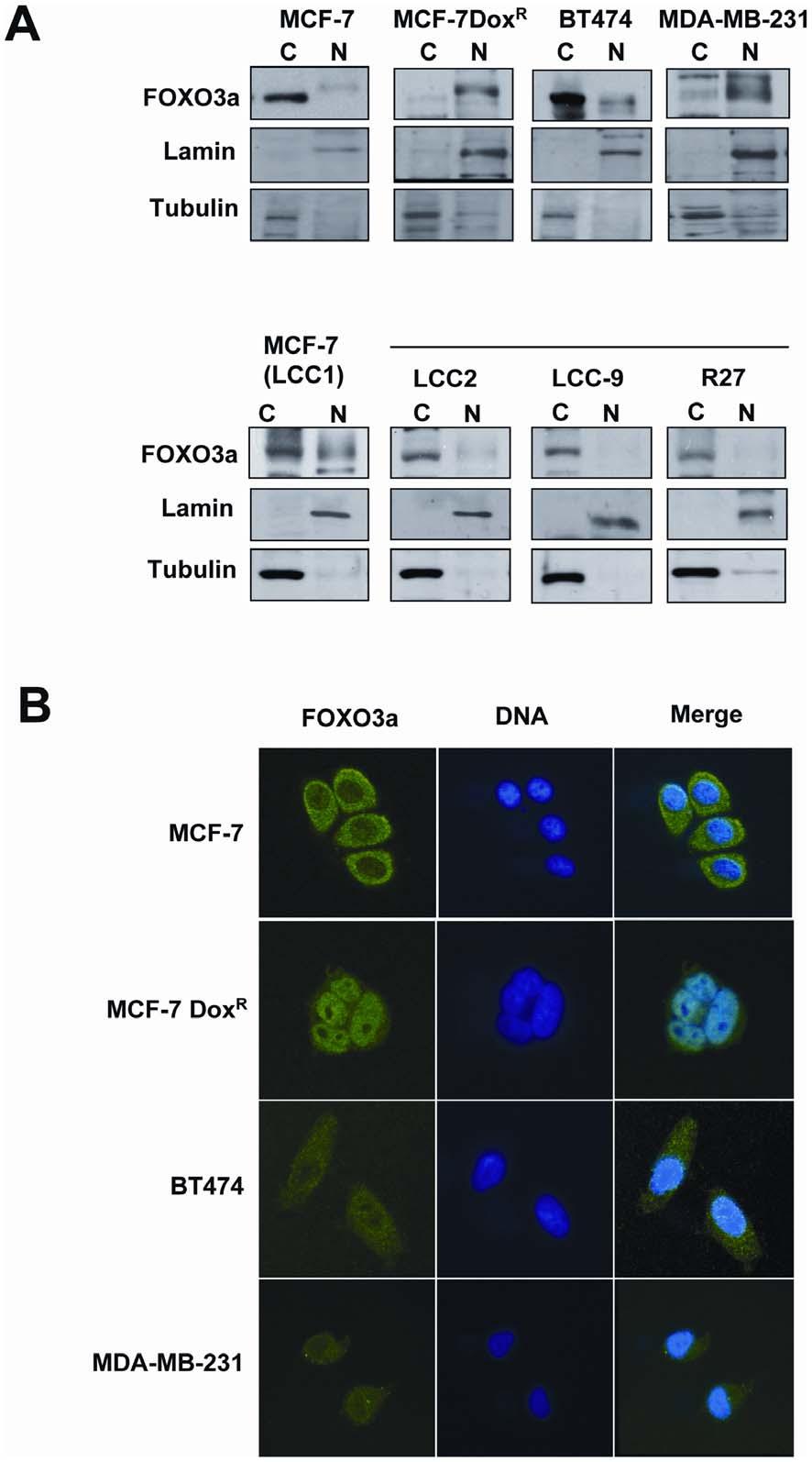 Figure 6. Nuclear location of FOXO3a in a panel of tamoxifen and/or doxorubicin sensitive and resistant breast carcinoma cell lines.