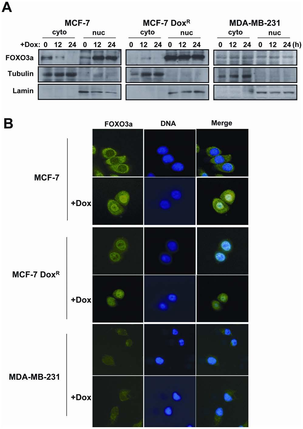 Figure 7. Doxorubicin treatment causes a nuclear relocation of FOXO3a expression. The doxorubicin sensitive MCF-7 and resistant MCF-7- Dox R and MDA-MB-231 cells were treated with 1 mm doxorubicin.