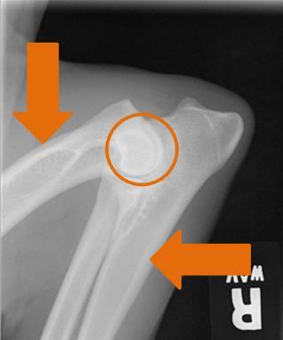 Elbow Radiographs: Flexed Lateral View When performing elbow radiographs, a quality control check system is performed. The guidelines for this check are listed for review.