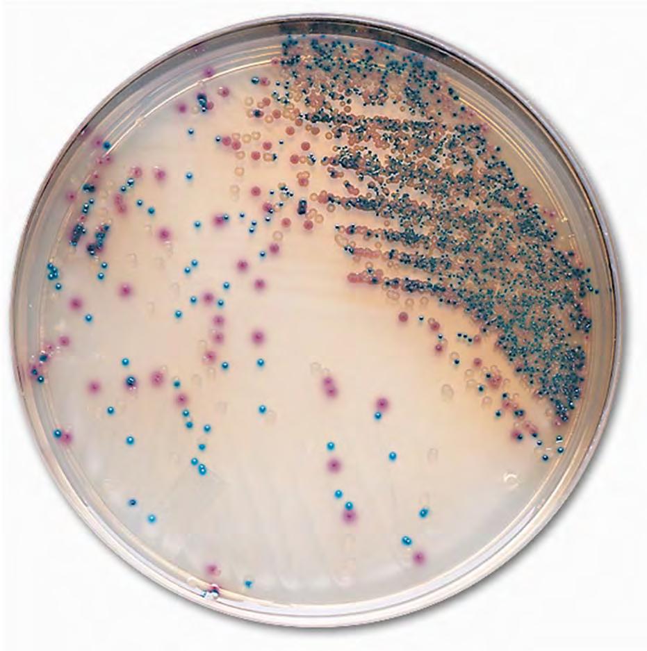 Typical Appearance of microorganisms E.coli dark pink to reddish Enterococcus turquoise blue Klebsiella, Enterobacter, Citrobacter metallic blue Proteus brown halo Pseudomonas cream, translucent S.